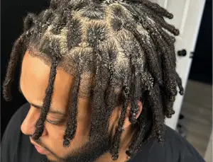 loc build up